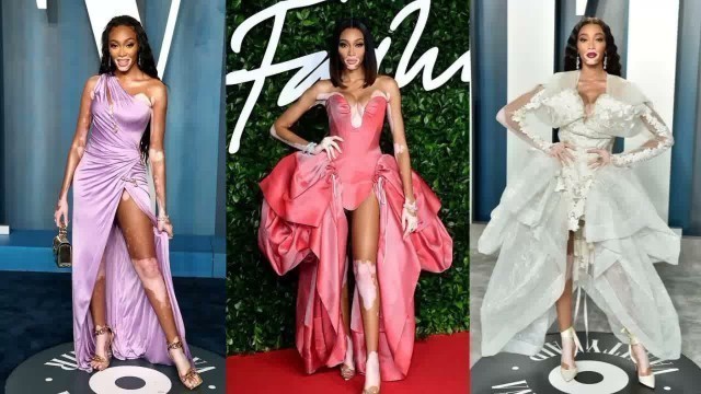 'Winnie Harlow\'s Chic Fashion Styles On Red Carpet 