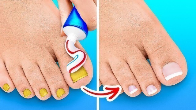 'FANTASTIC SHOE HACKS | Beauty Tricks,Trendy Fashion Tips And Easy Makeup Ideas'