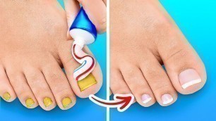 'FANTASTIC SHOE HACKS | Beauty Tricks,Trendy Fashion Tips And Easy Makeup Ideas'